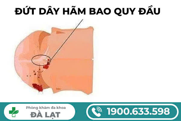 Hình ảnh minh họa